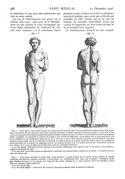 La castration est criminalisée de façon spécifique et punie sévèrement en France à partir du XIXe siècle. 